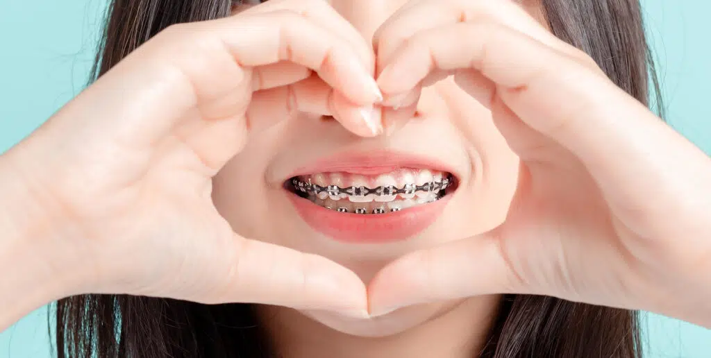 A teenager making heart hands around her smile which has traditional metal braces straighten her teeth