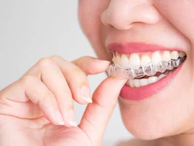 Invisalign Is Changing the Game: A Breakthrough in Orthodontics
