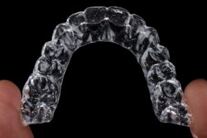 Average Cost of Invisalign