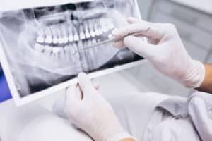 Ceramic Braces vs. Invisalign