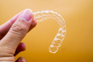 Invisalign Journey: Step-by-Step Guide to a Perfect Smile