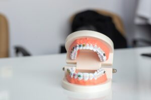 What's the Best Age to Get Braces? Critical Tips for Perfect Timing