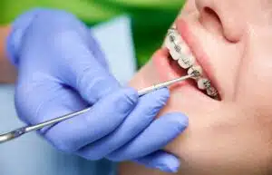 Orthodontic Treatment