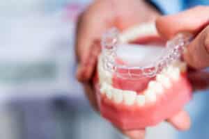Preventing Invisalign Stains From Coffee