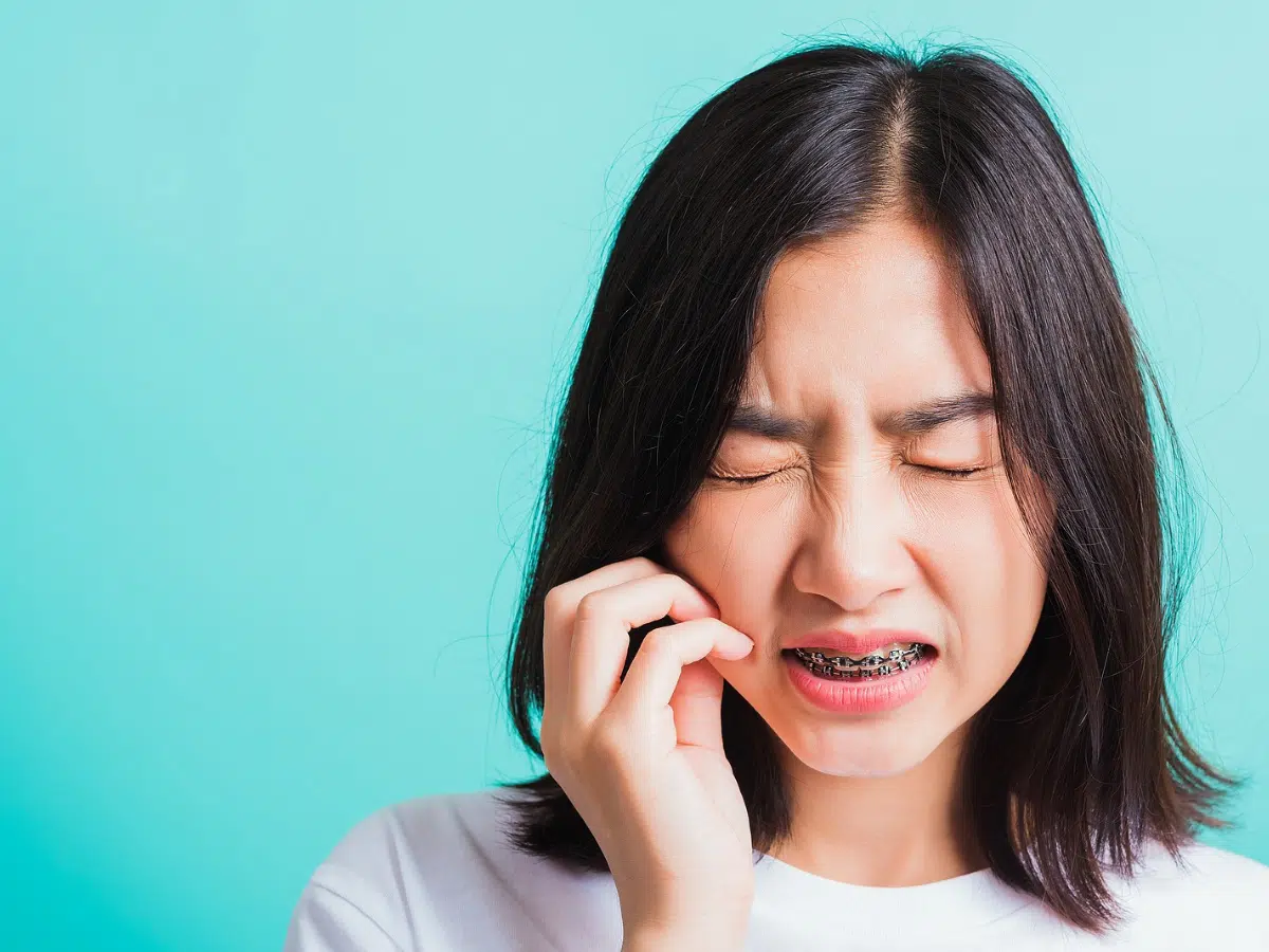 Young woman with braces holding her cheek in discomfort, showing what it feels like when braces hurt
