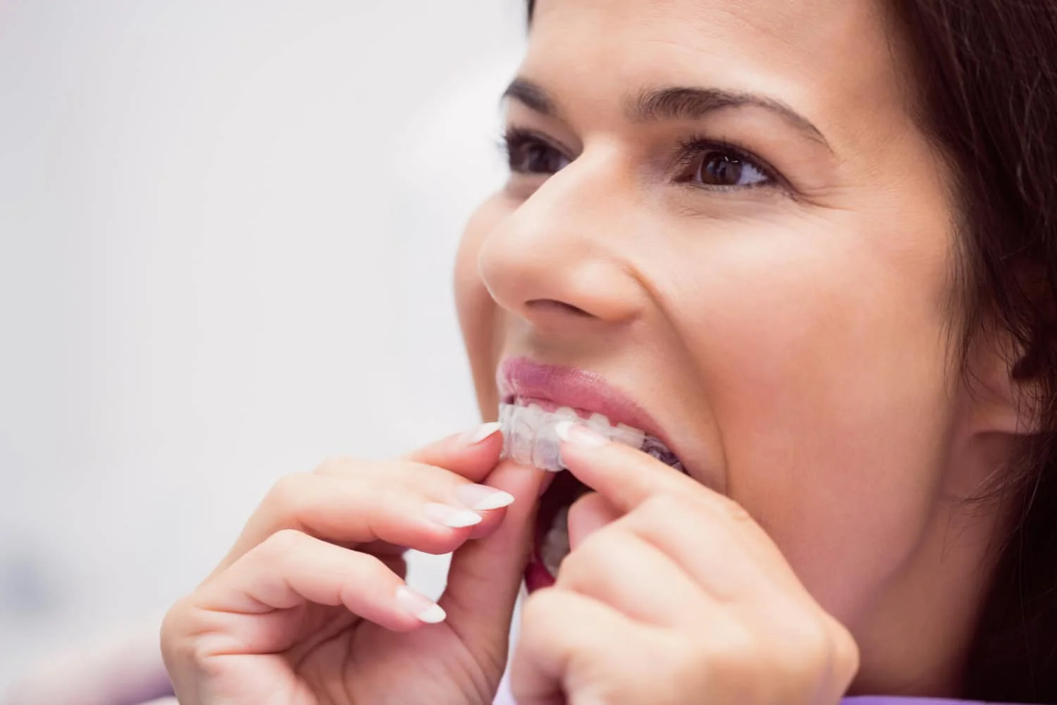 Invisalign Emergencies: Pro Tips for Handling Aligner Issues