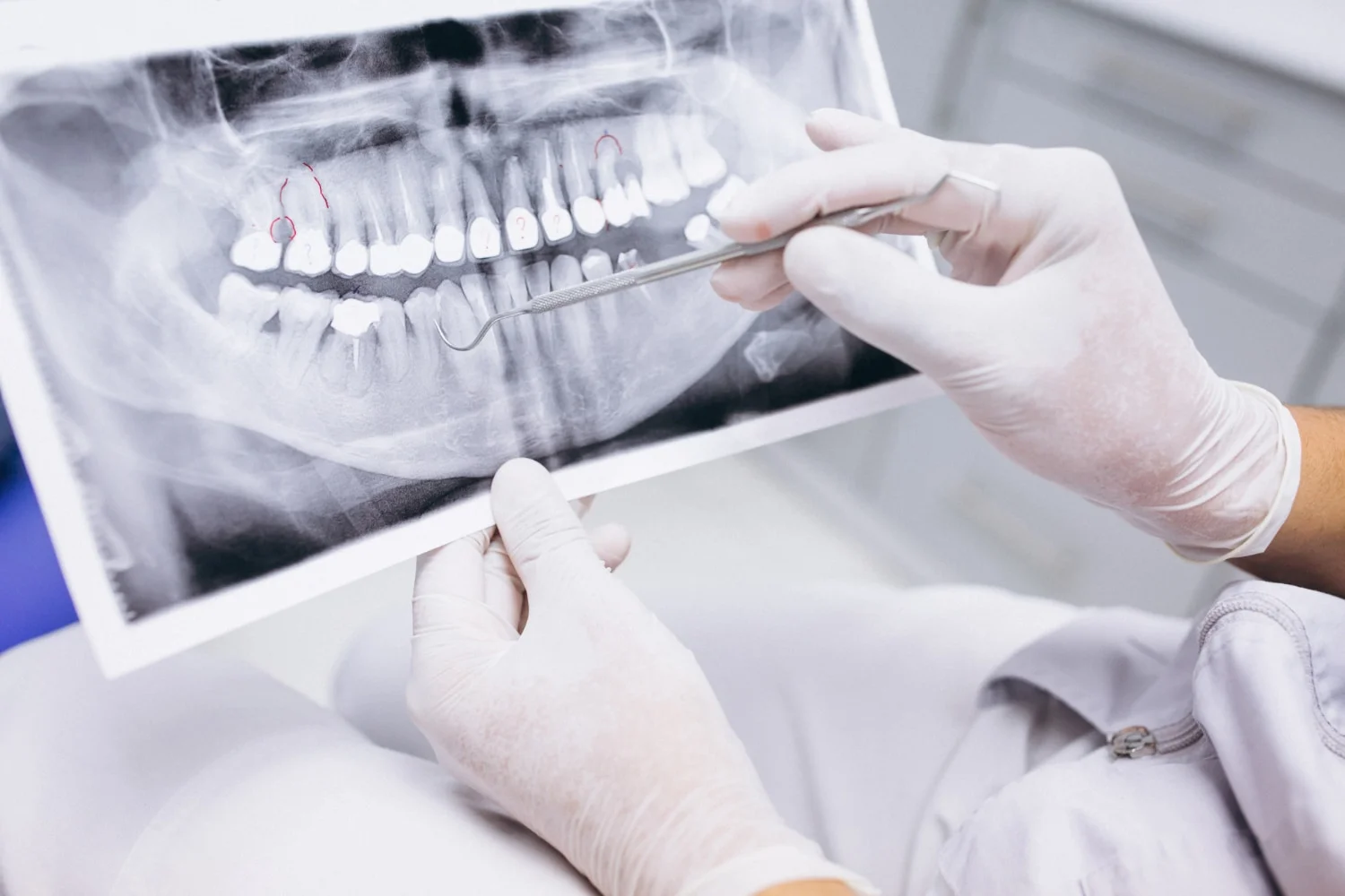Ceramic Braces vs. Invisalign