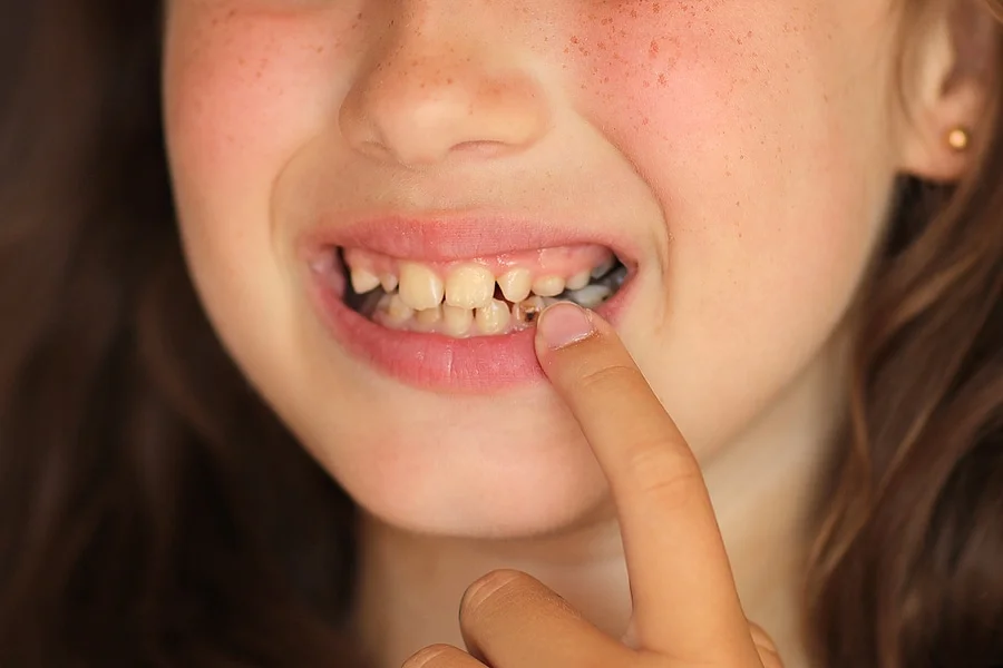 early orthodontic treatment Brooklyn NY