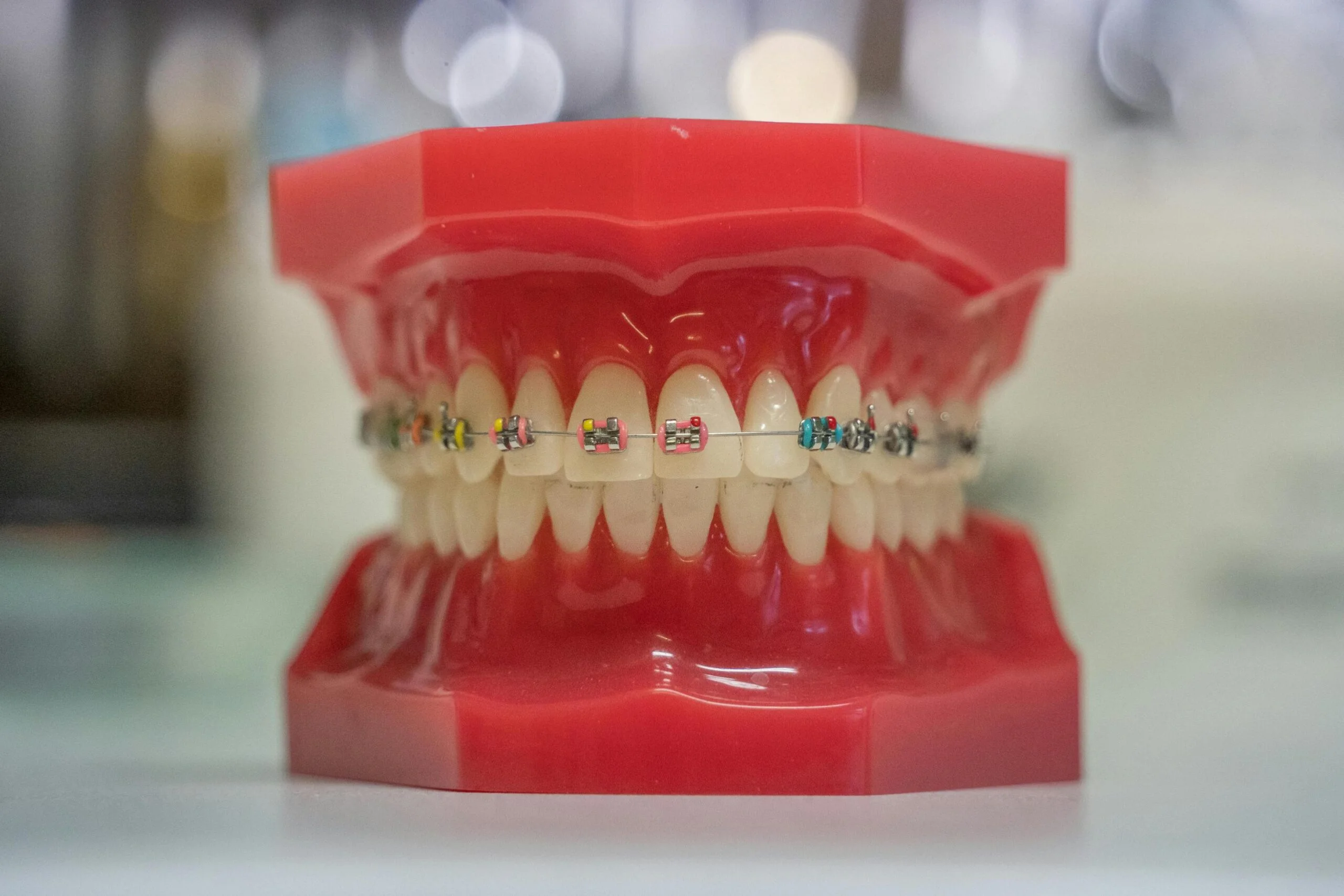 braces bands colours