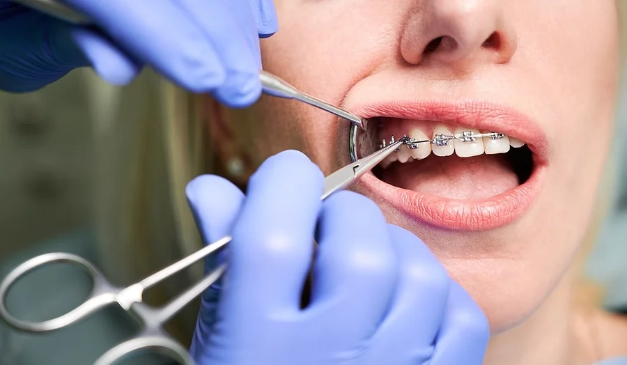 A dentist in purple gloves performing a dental examination on a young patient.